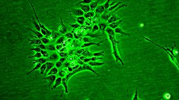 Pflanzenzellen Mokroskopansicht grün.jpg